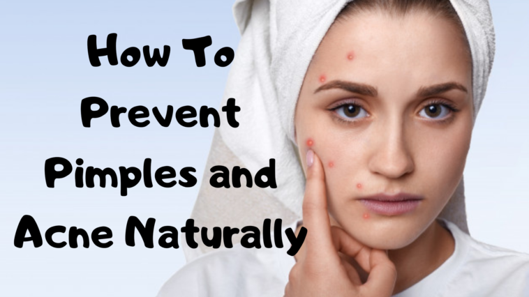 How To Prevent Pimples