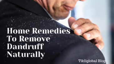 How To Remove Dandruff Naturally