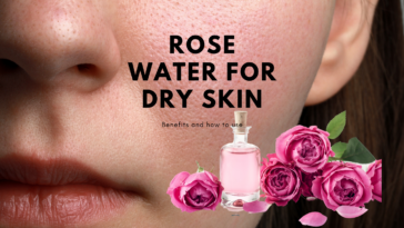 Rose water for Dry skin